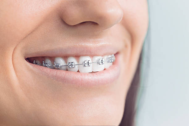 Best Traditional Braces  in Ocean View, DE